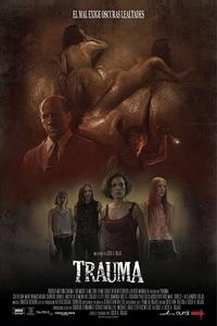 Травма Травма